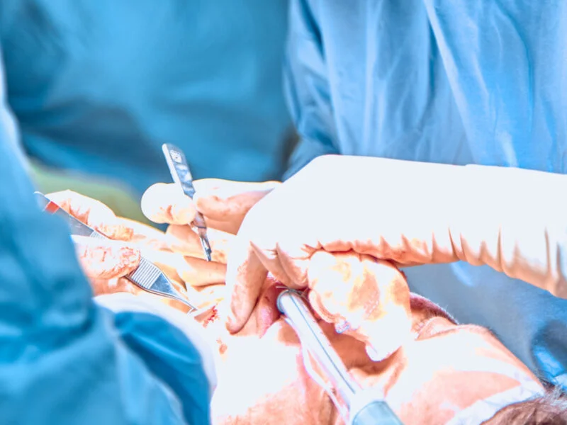 Patologie oncologiche cervico-facciali