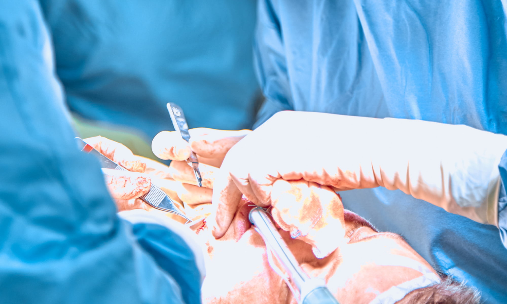 Patologie oncologiche cervico-facciali